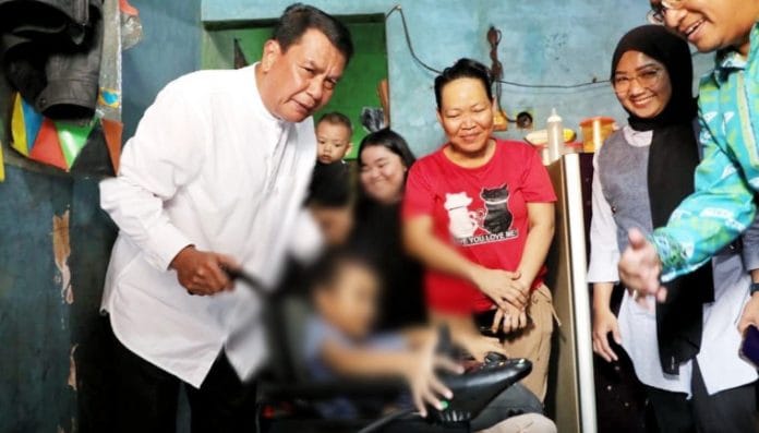 Kunjungi Warganya yang di Amputasi, Bupati Tangerang Beri Motivasi dan Bantuan