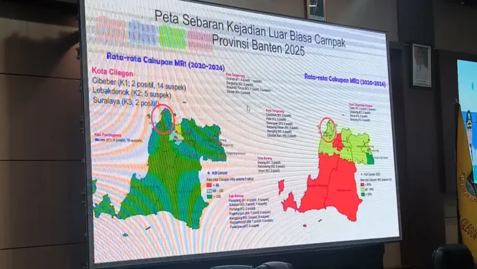Empat Kecamatan di Cilegon KLB Campak, Pemkot Percepat Imunisasi Rubela